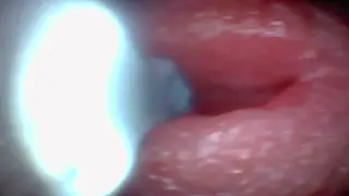 Doctor Uses Endoscope to Capture POV Blowjob and Cumshot