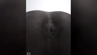 Solo Guy Shows Off Gaping Hole in Close-Up