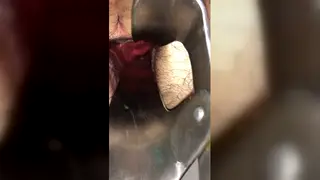 Slim Bottom Gaped by Speculum and Deep Fist