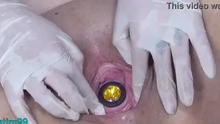 Mature European MILF Endures Extreme Cervix Stretching