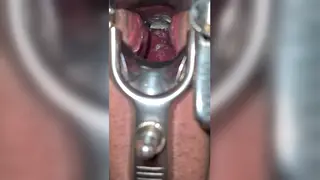 Pregnant European MILF Spreads Wide for Gyno Exam