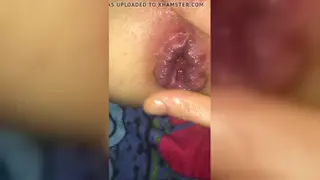 Slim Twink Endures Deep Fisting and Gaping Bareback