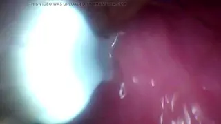 Older Man Submits to Hospital Femdom Exam