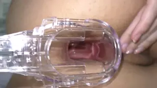 European Beauty Explores Anal Depths in Closeup
