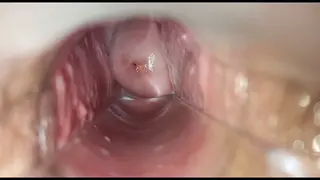 Solo Woman Reaches Pulsating Orgasm With Speculum Close-Up