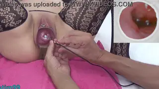 Japanese MILF Examines Cervix With Endoscope on Webcam