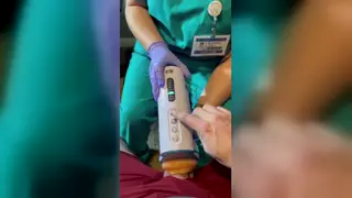 Nurse Helps Patient With Milking Machine at Hospital